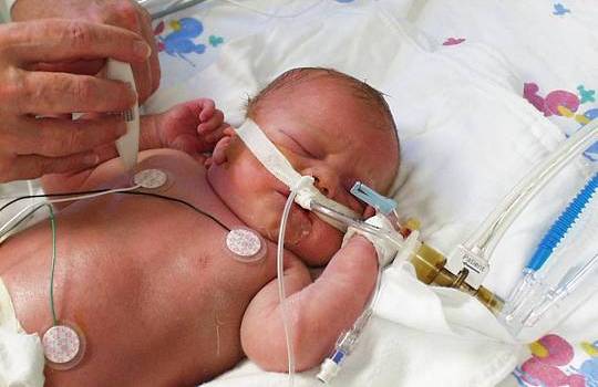 James at birth
